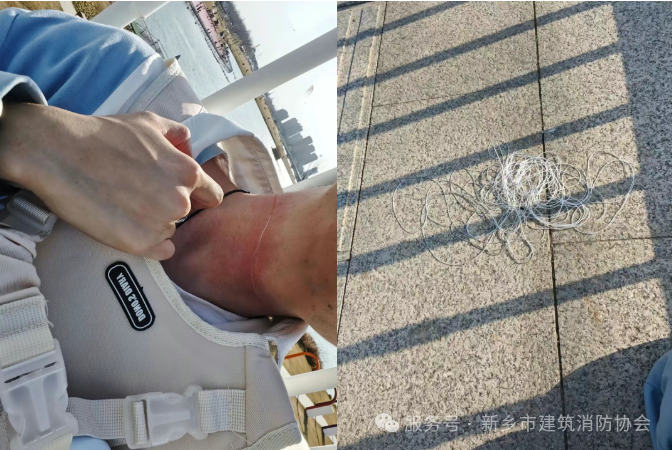 春季多发！小心空中飘着的这把“隐形利刃”，多人已被割伤！